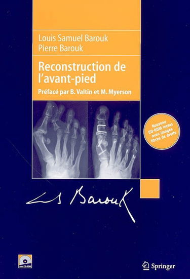 Reconstruction de l'avant-pied