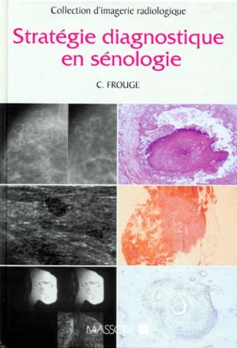 Stratégie diagnostique en sénologie