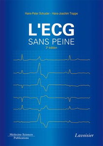 L'ECG sans peine