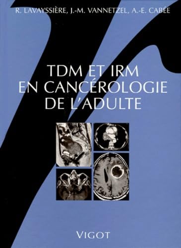 IRM et TDM en cancérologie de l'adulte