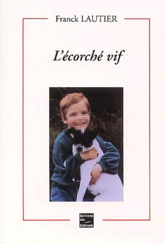 L'écorché vif
