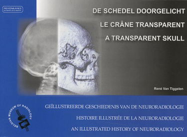 De schedel doorgelicht : geïllustreerde geschiedenis van de neuroradiologie. Le crâne transparent : histoire illustrée de la neuroradiologie. A transparent skull : an illustrated history of neuroradiology