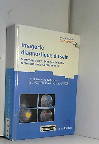 Imagerie diagnostique du sein : mammographie, échographie, IRM, techniques inventionnelles