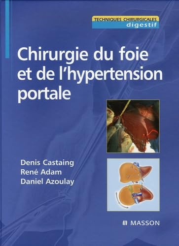 Chirurgie du foie et de l'hypertension portale