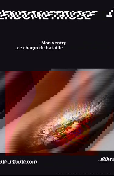 L'ENDOMETRIOSE: Mon ventre, ce champ de bataille