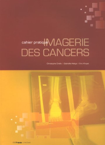 Cahier pratique d'imagerie des cancers