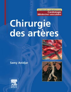 Chirurgie des artères