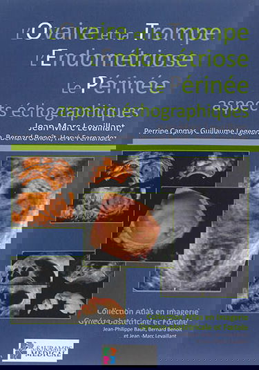 L'ovaire et la trompe, l'endométriose, le périnée : aspects échographiques