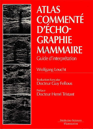 Atlas commenté d'échographie mammaire : guide d'interprétation