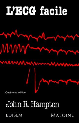 L'Ecg Facile. Edition 1992