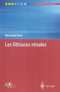 Les lithiases rénales