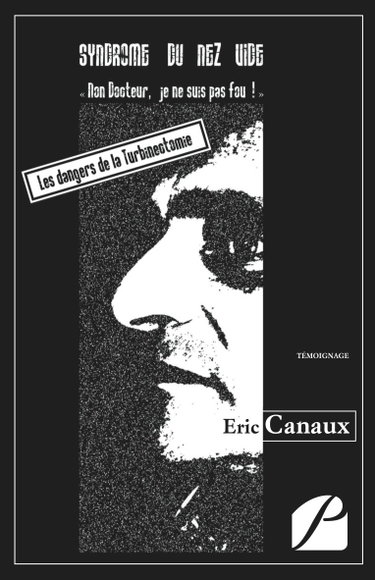 Couverture de Syndrome du Nez Vide
