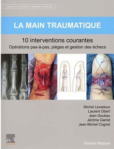 Manuel de chirurgie du membre supérieur. Vol. 2. La main traumatique : 10 interventions courantes : opérations pas-à-pas, pièges et gestion des échecs