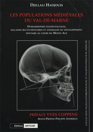 Les populations médiévales du Val-de-Marne : dysharmonies cranio-faciales, maladies bucco-dentaires et anomalies du développement dentaire au cours du Moyen Age